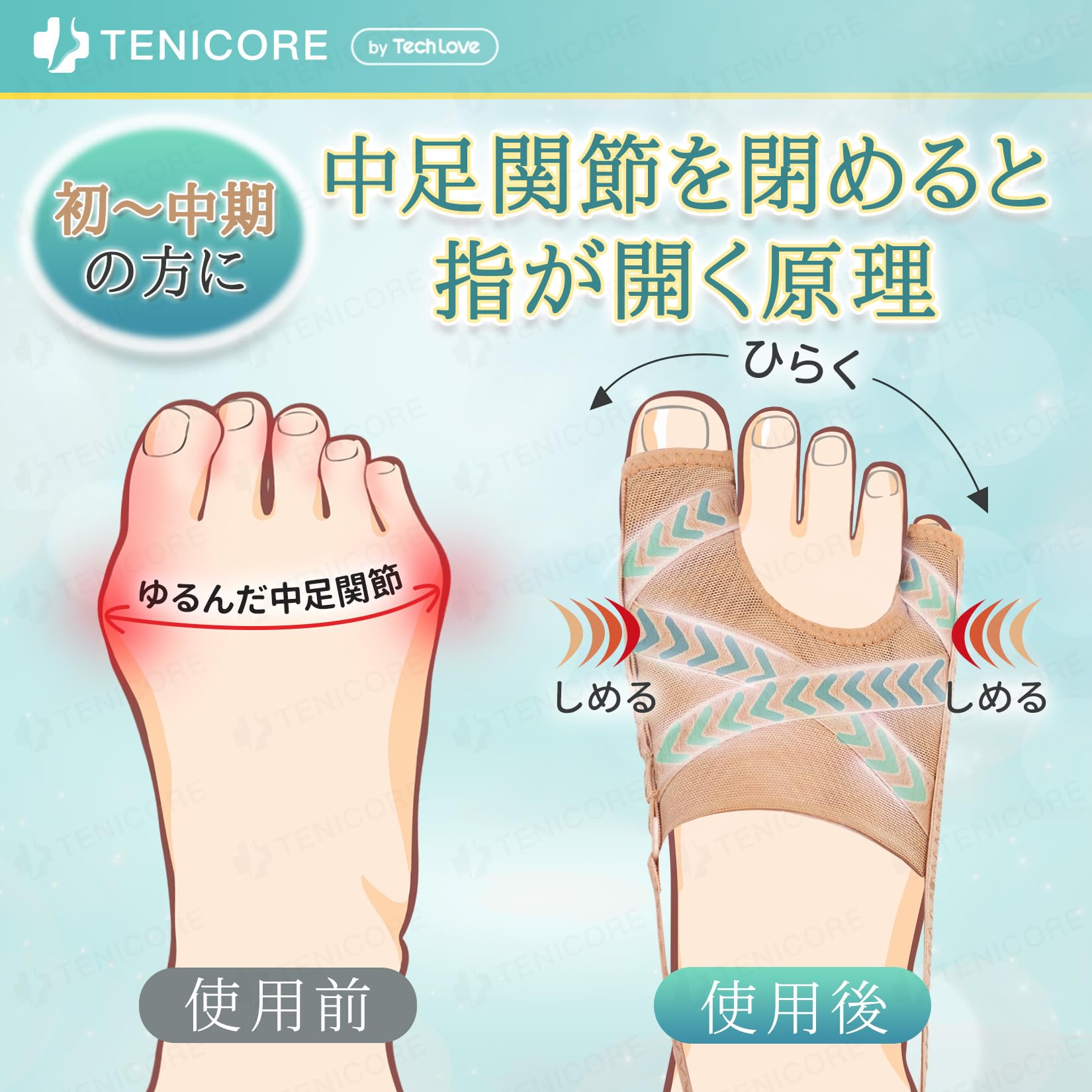 Amazon | 「二個入・Sサイズ」Tenicore 母趾・小趾サポーター 薄型調整 