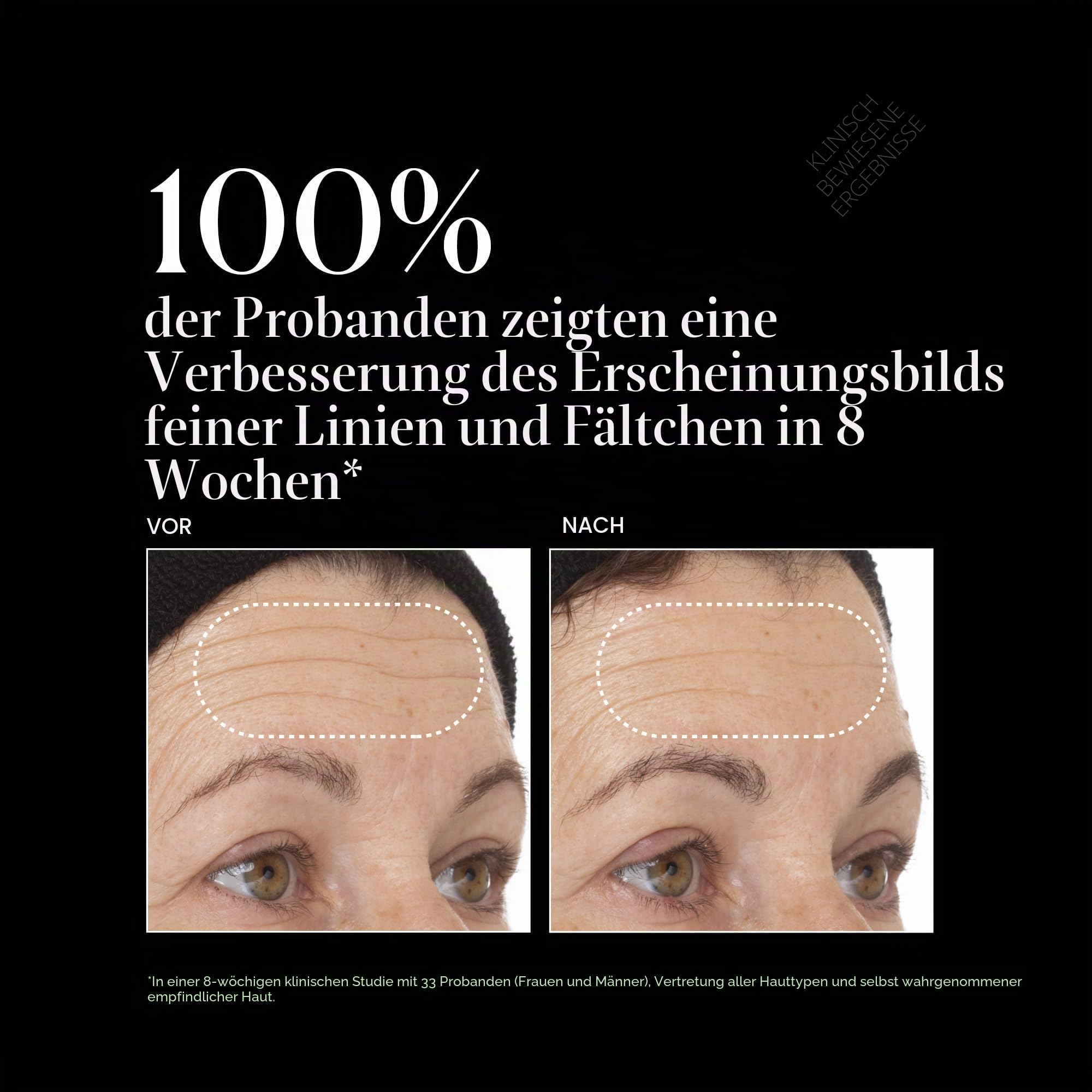 Vitamin C Super Serum Plus, Anti-Aging, Anti-Falten-Gesichtsserum mit Vitamin C, Retinol, Hyaluronsäure, Niacinamid und Salicylsäure, 1 fl oz