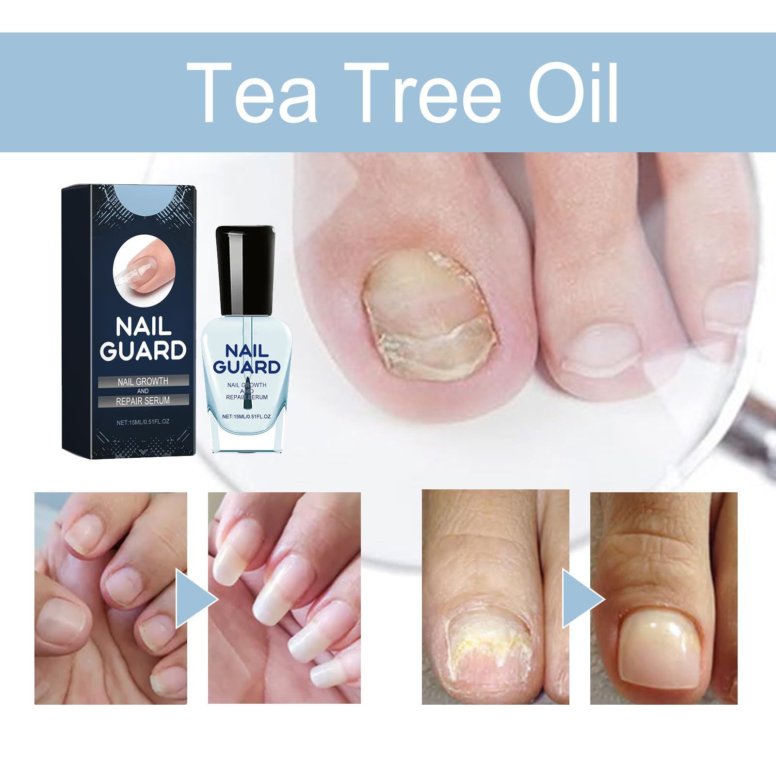 2pcs Nail Serum for Growth and Strength, 2 * 15ml Treatment for Weak and Damaged Nails/Toenails - Image 2