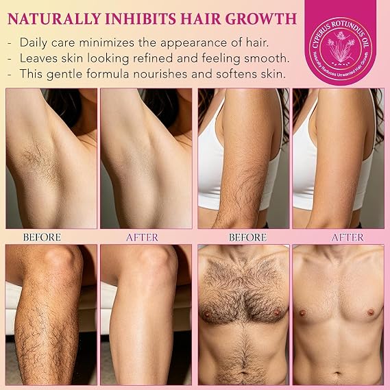 Cyperus Rotundus Oil, Cyperus Rotundus Oil for Hair Removal, Natural Hair Inhibitor Oils for Reducing Unwanted Body Hair Growth, Hydrating & Soothing Skin Care-Oil for Body, Shrinks Pores (2 Pack)