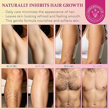 Cyperus Rotundus Oil, Cyperus Rotundus Oil for Hair Removal, Natural Hair Inhibitor Oils for Reducing Unwanted Body Hair Growth, Hydrating & Soothing Skin Care-Oil for Body, Shrinks Pores (2 Pack)