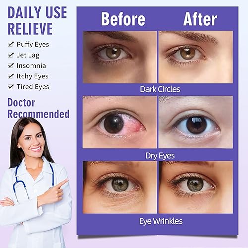 Miniatura 4 de Serfeymi Paquete de 22 máscaras de ojos de vapor que se calientan automáticamente, cubrebocas desechables para ojos con calefacción para dormir,