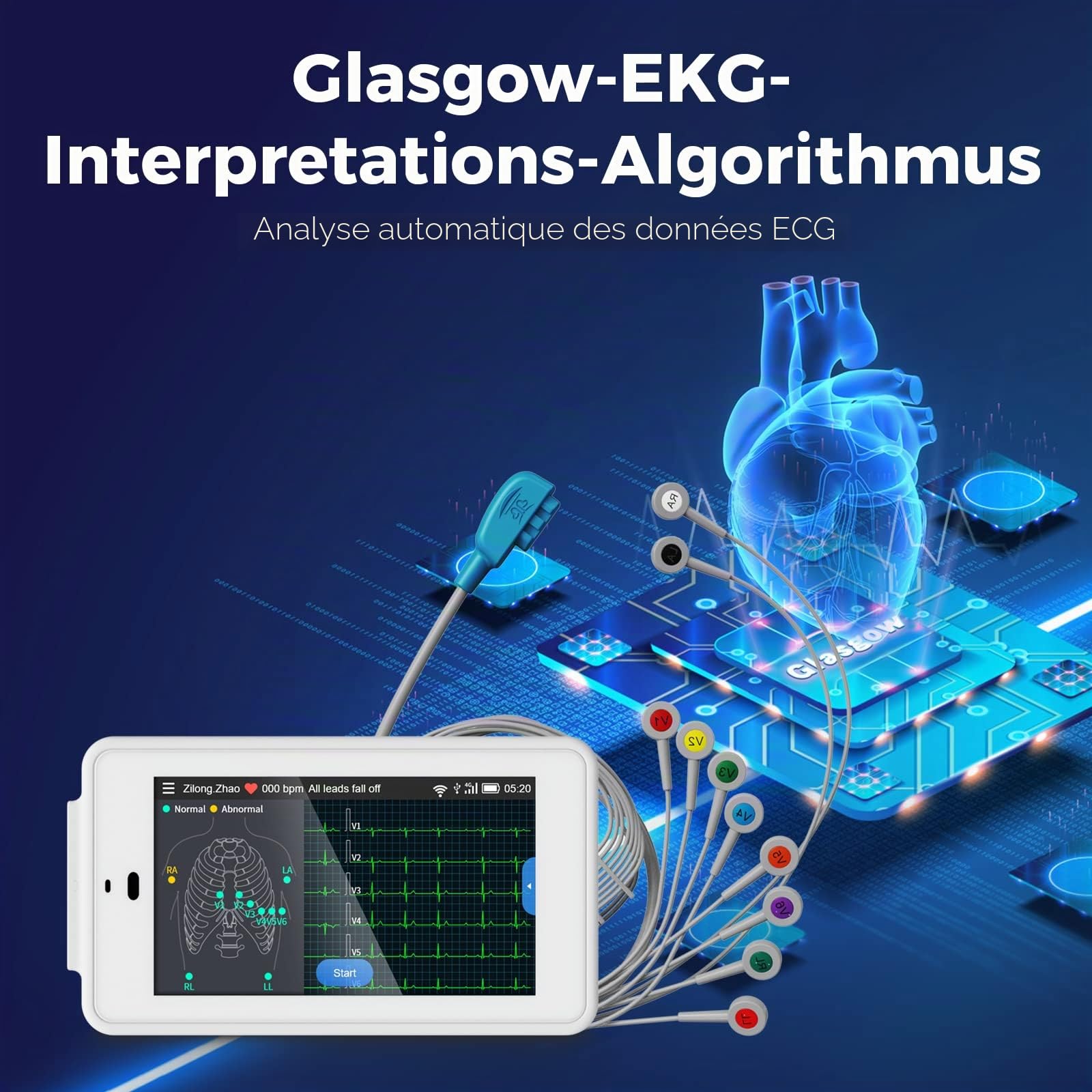 CheckMe ECG professionnel à 12 dérivations, ECG numérique avec algorithme de Glasgow, acquisition et analyse de données ECG en temps réel, transfert de données WIFI et impression de rapports