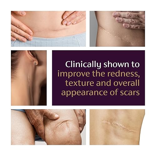 Miniatura 5 de Mederma Gel avanzado para cicatrices, 1 x diario que reduce la apariencia de cicatrices nuevas y antiguas, marca #1 recomendada por farmacéuticos