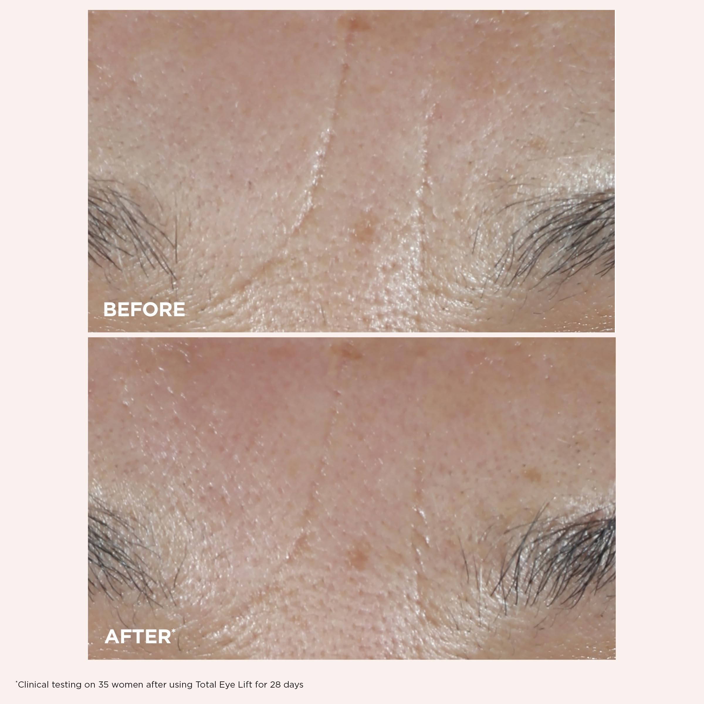 Clarins NEW Total Eye Lift | Anti Aging Eye Cream | Targets Wrinkles, Crow's Feet, Dark Circles and Puffiness For a Visible Eye Lift in 30 Seconds | REFILLABLE