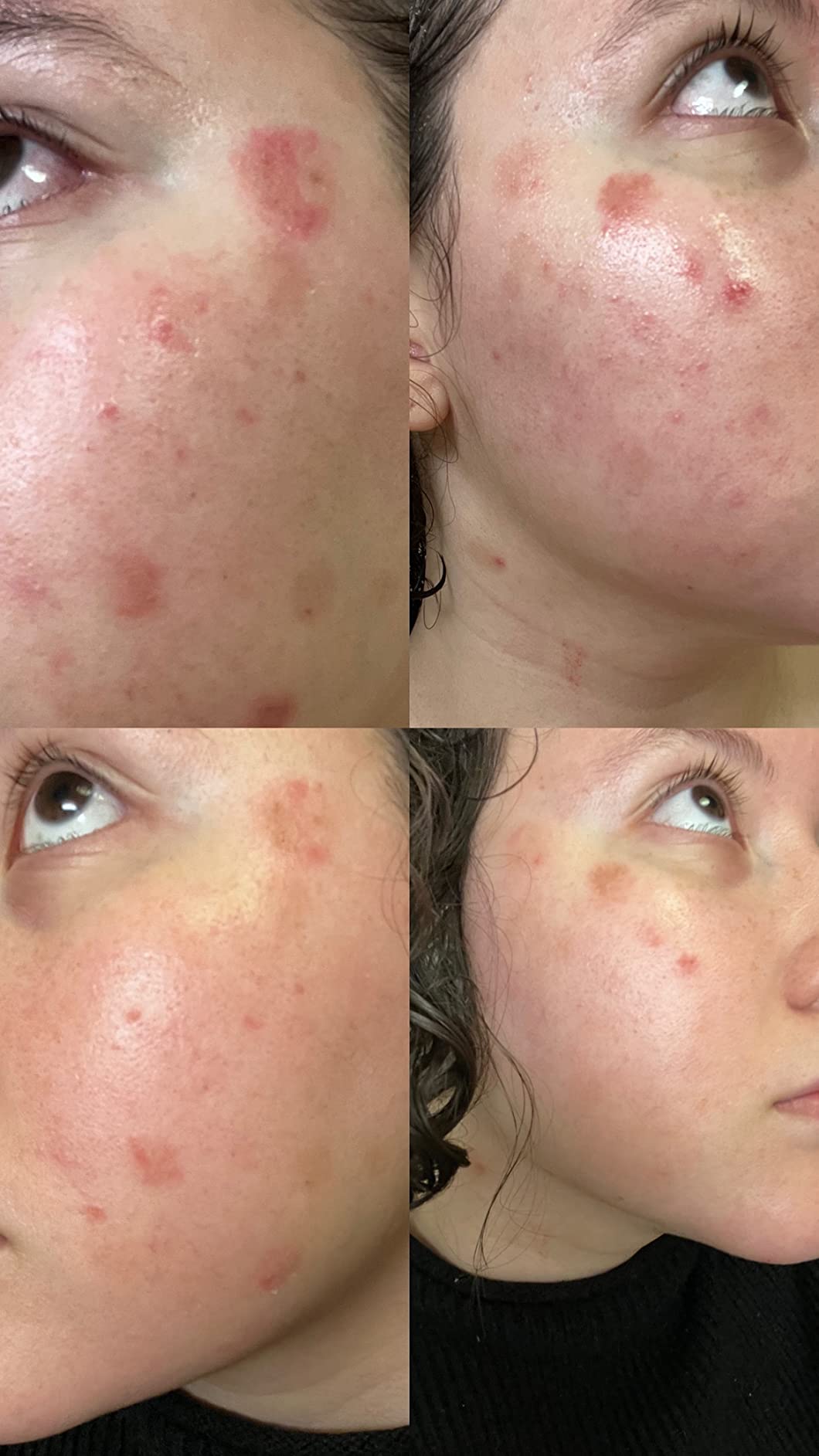 Excellent for Eczema