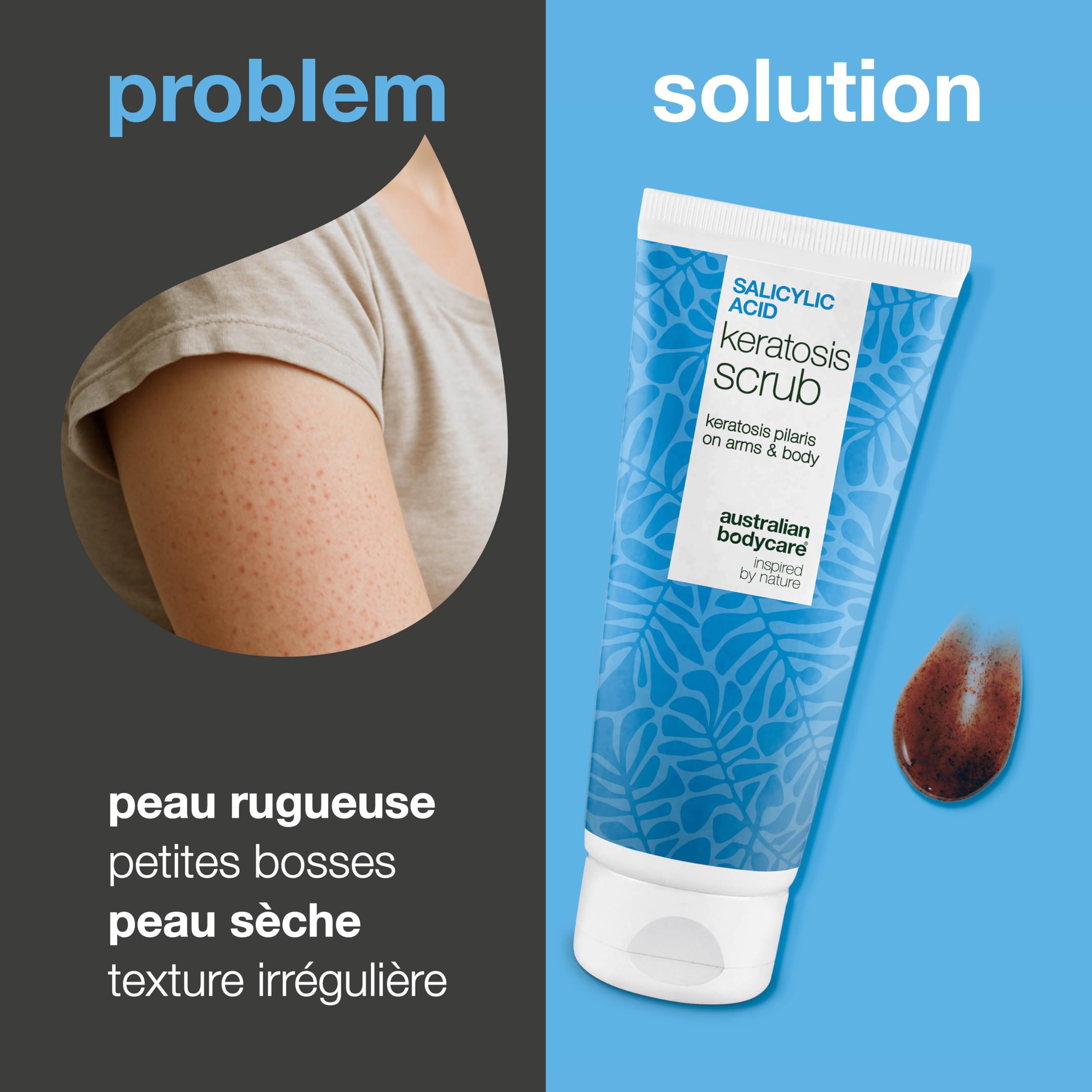 Gommage Corps Exfoliant kératose pilaire traitement, peau de fraise et poils incarnés – peeling chimique (AHA/BHA) + physique à double action à l’acide salicylique, acide glycolique et noyau d’abricot