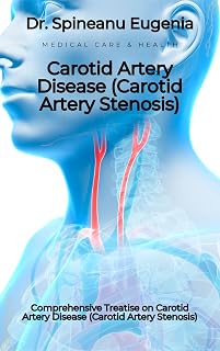 Comprehensive Treatise on Carotid Artery Disease (Carotid Artery Stenosis) (Medical care and health)