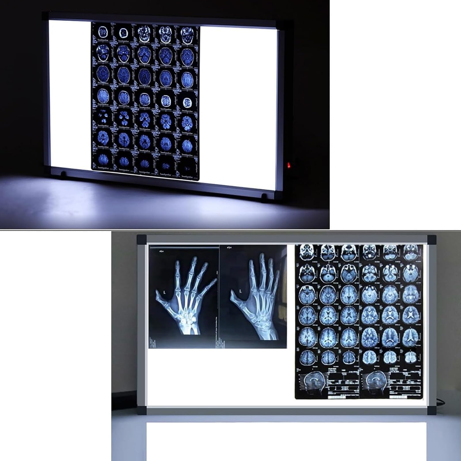 Lampada a LED per Pellicole Radiografiche, Visore per Pellicole per Apparecchiature Mediche, Negativoscopio Portatile per Pellicole Radiografiche Ortopediche e Dentali, Senza Ombre