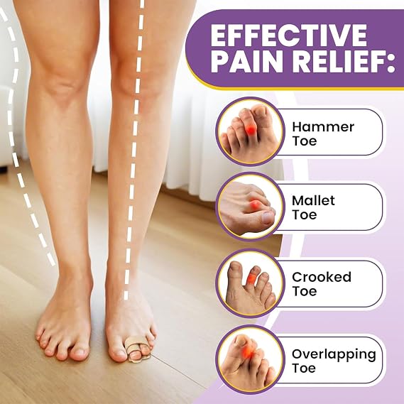 2 Pack Toe Separators for Hammer Toes, Toe Bandages for Broken Toes, Toe Corrector for Men and Women, Toe Splints for Correcting Hammer Toes, Crooked (Beige)