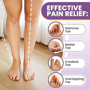 2 Pack Toe Separators for Hammer Toes, Toe Bandages for Broken Toes, Toe Corrector for Men and Women, Toe Splints for Correcting Hammer Toes, Crooked (Beige)