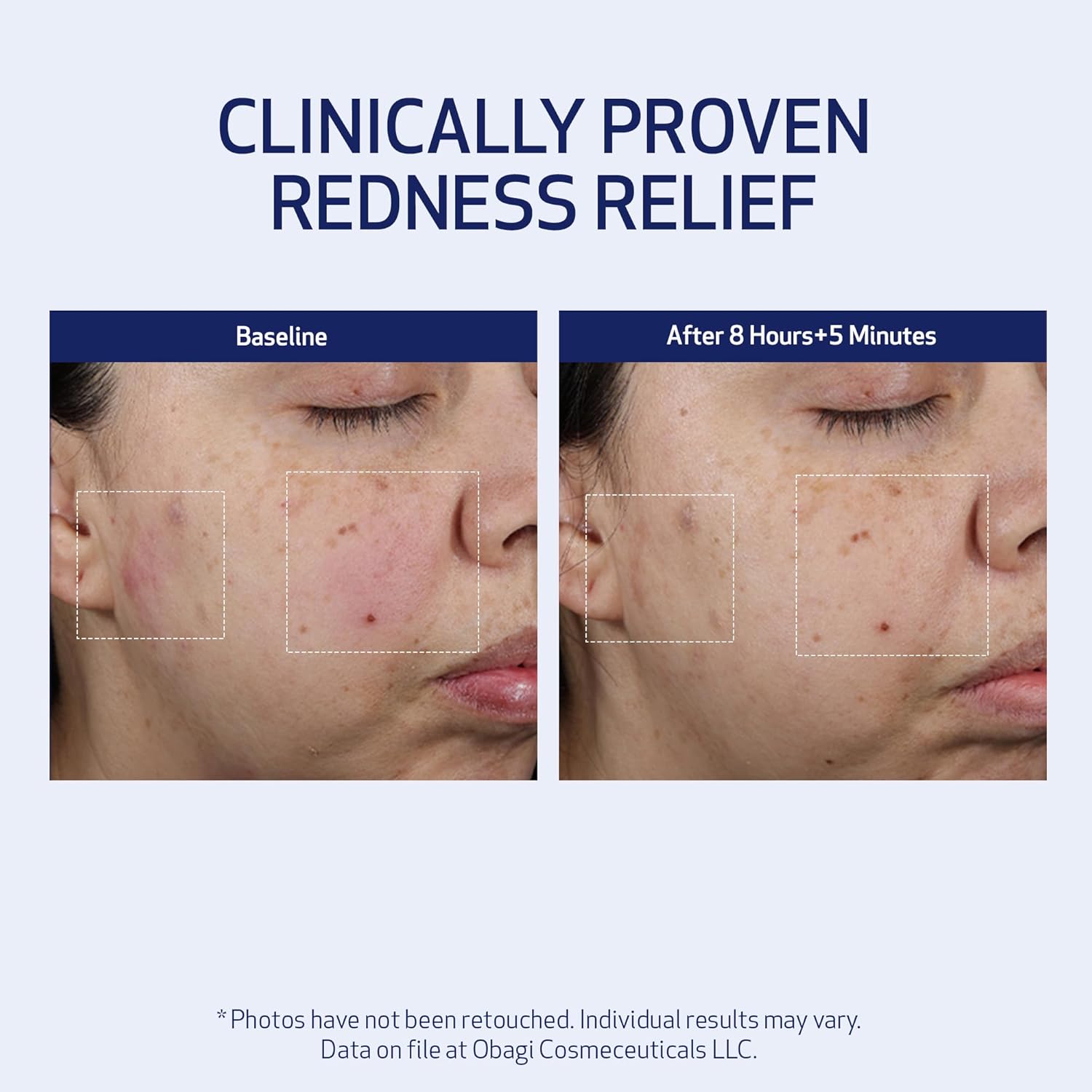 SUZANOBAGIMD Moisture Restore – Medical-Grade Multi-Layered Moisture Provides Redness Relief, Long-Lasting Hydration + Improves Skin Texture & Firmness – Suitable for All Skin Types – 1.7 oz - Image 3