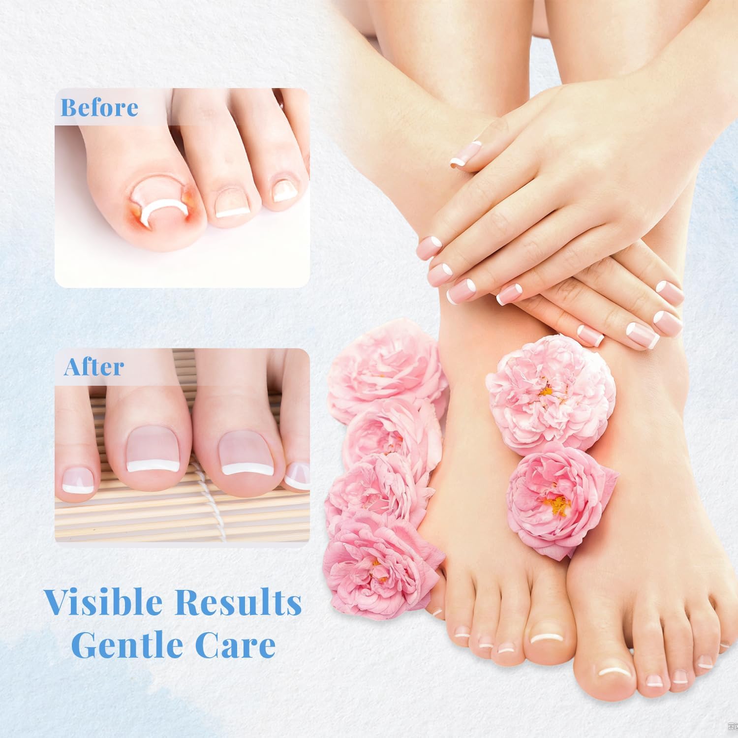 Ingrown Toenail Pedicure Tool Kit, Nail Care, Professional Pedicure Tools Set for Toenail Care, Stainless Steel Clippers, Lifter, File & Nail Cleaner, Painless File and Lifter Pedicure Tools