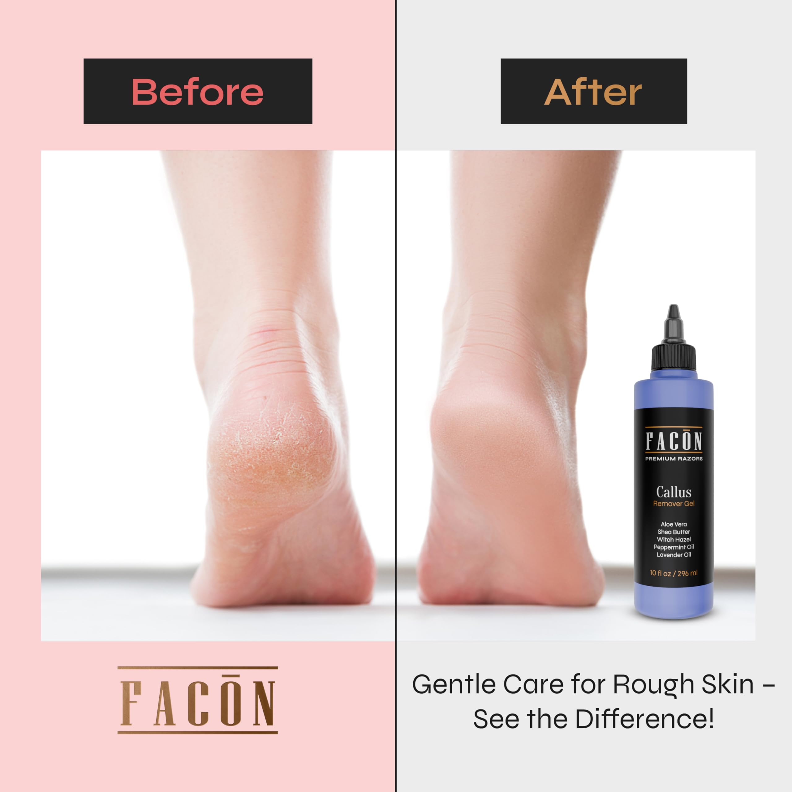 Facón Gel eliminador de callos profesional para pies con aloe vera, manteca de karité, menta y hamamelis, suavizante de callos con aroma a lavanda, spa de pies para pedicura en casa, elimina la piel 3