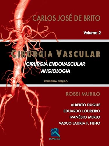 Cirurgia Vascular: Cirurgia Endovascular - Angiologia - 2 Volumes