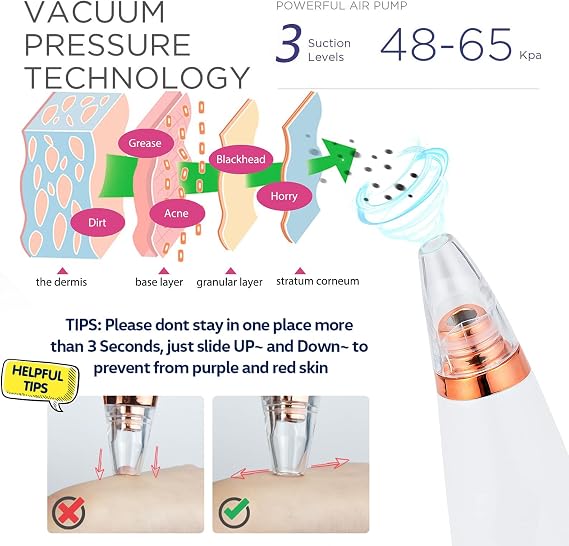 Blackhead Remover Vacuum, Black Head Remover for Face, Blackhead Extractor with 3 Suction Power, 6 Suction Probes, 4 pcs Pimple Popper Tool Kit, USB Interface Type Pore Vacuum