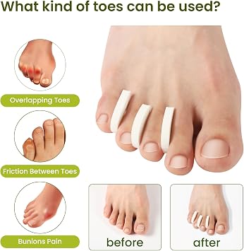 Bukihome 100 Pack Foam Toe Separators - Correct Overlapping Toes and Reduce Friction - Breathable and Comfortable, Foam Toe Spacers for Women