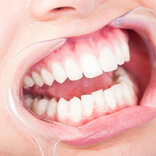 Miniatura 25 de JMU Retractor dental de mejillas, abreboca en forma de C envuelto individualmente, transparente (5S/10M/5L) - (20 piezas)