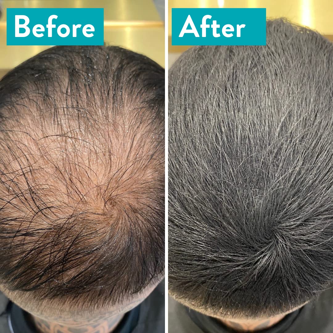 MR Hair Building Fibres Black, 15g. Disguise and Cover up thinning or