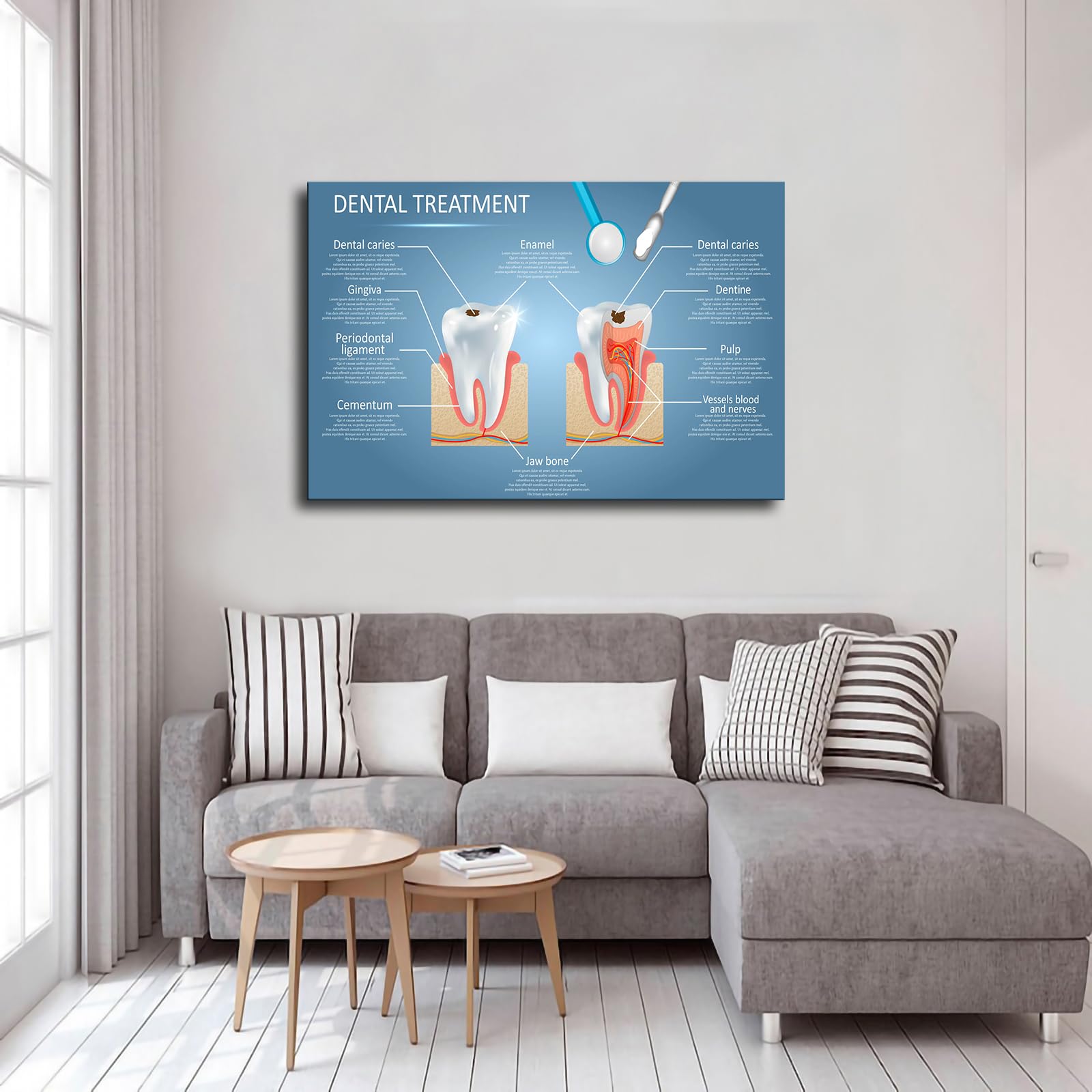 WAyom Vector Dental Anatomy and Tooth Structure Diagram Poster Modern Family Bedroom Office Background Wall Art HD Picture Canvas Printing Artwork Decor Posters (08×12inch-Framed)