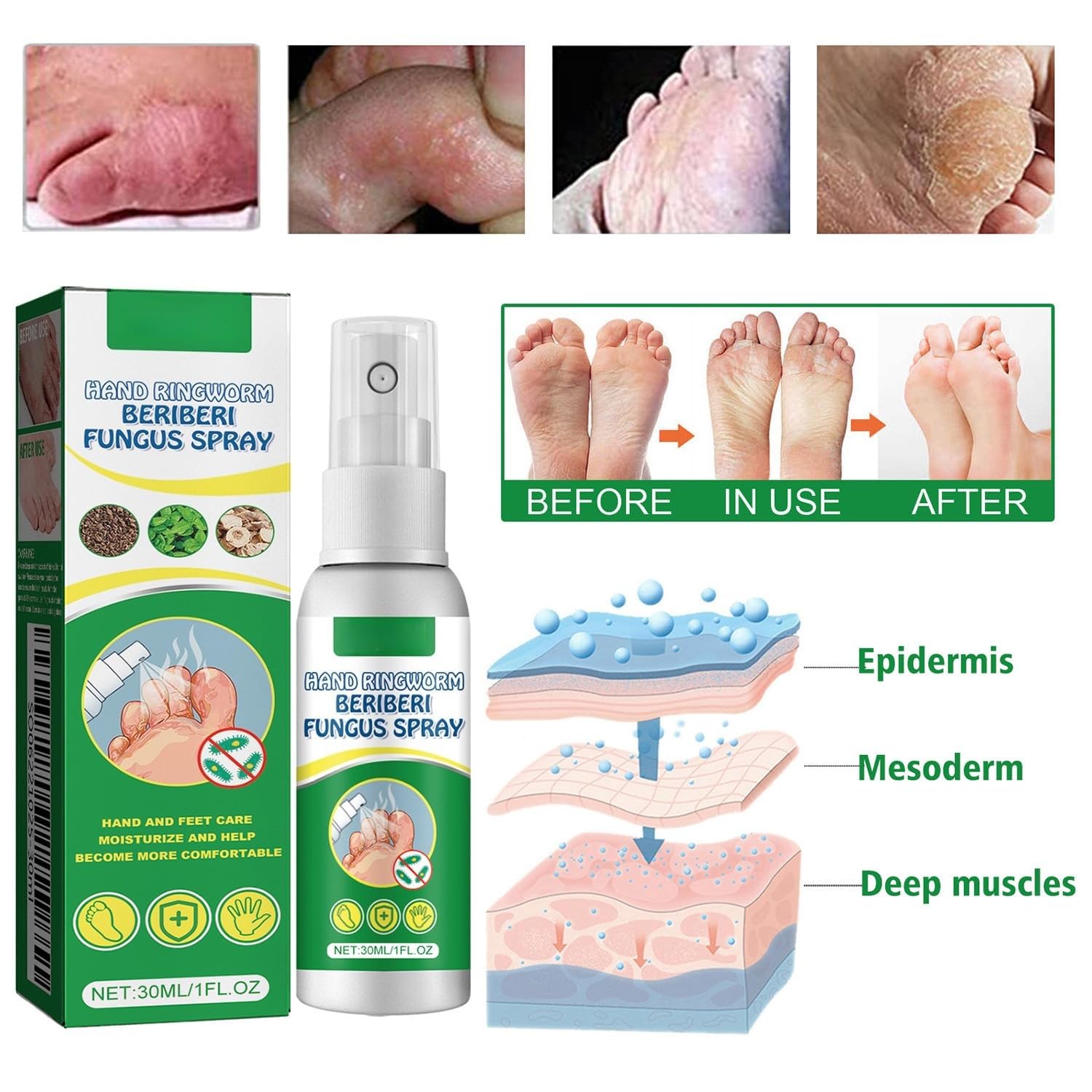 Spray para Pies, Spray para Pie de Atleta, Spray para el cuidado de los pies, Hidratante y reparador, Mujeres y Hombres Adultos, 30ml
