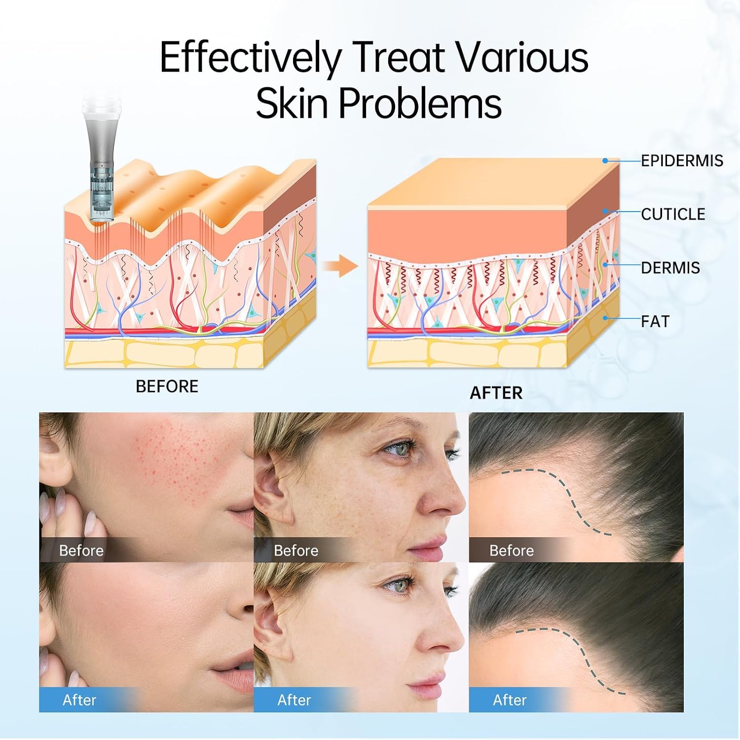 Dr.Pen M8 Microneedling Pen Wireless Micro Needling Devices Hautpflege Tool Kit für Anti-Aging Akne Narben Falten mit 10 Stück Nano Round Patronen
