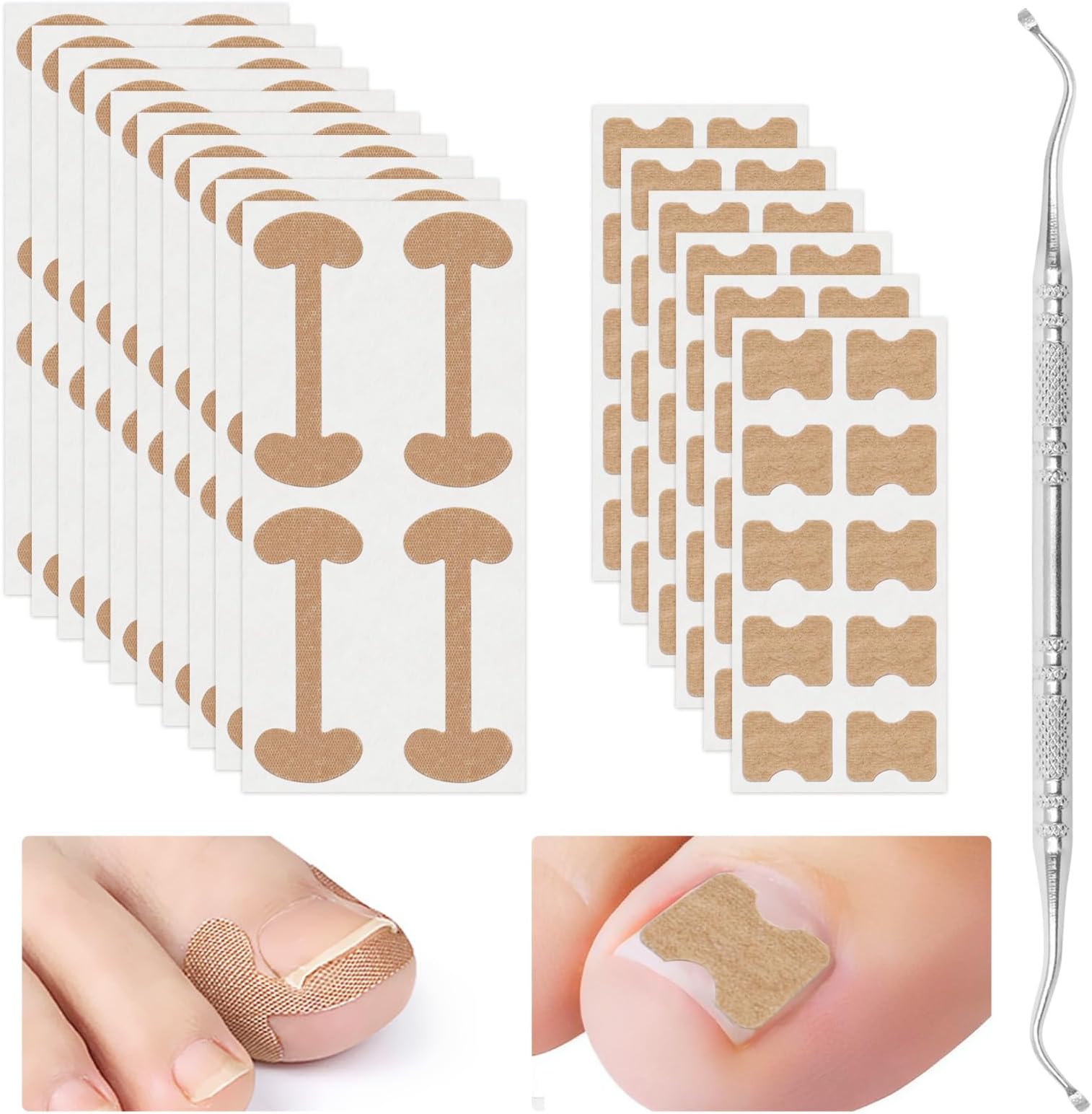 2 Types Ingrown Toenail Treatment Patch with Ingrown Toenail Tool, Professional Ingrown Toenail Corrector Tools for Toenail Care Protect Toe Nail