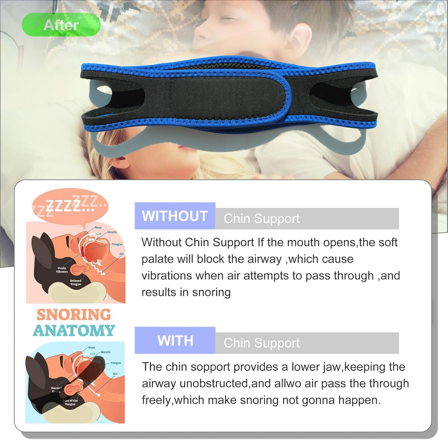 Anti Snoring Chin Strap, Adjustbale and Air Permeable Snore Stopper Chin Straps, Improving Sleeping Quality Anti Snore Chin Strap,for Man and Woman. (Blue)