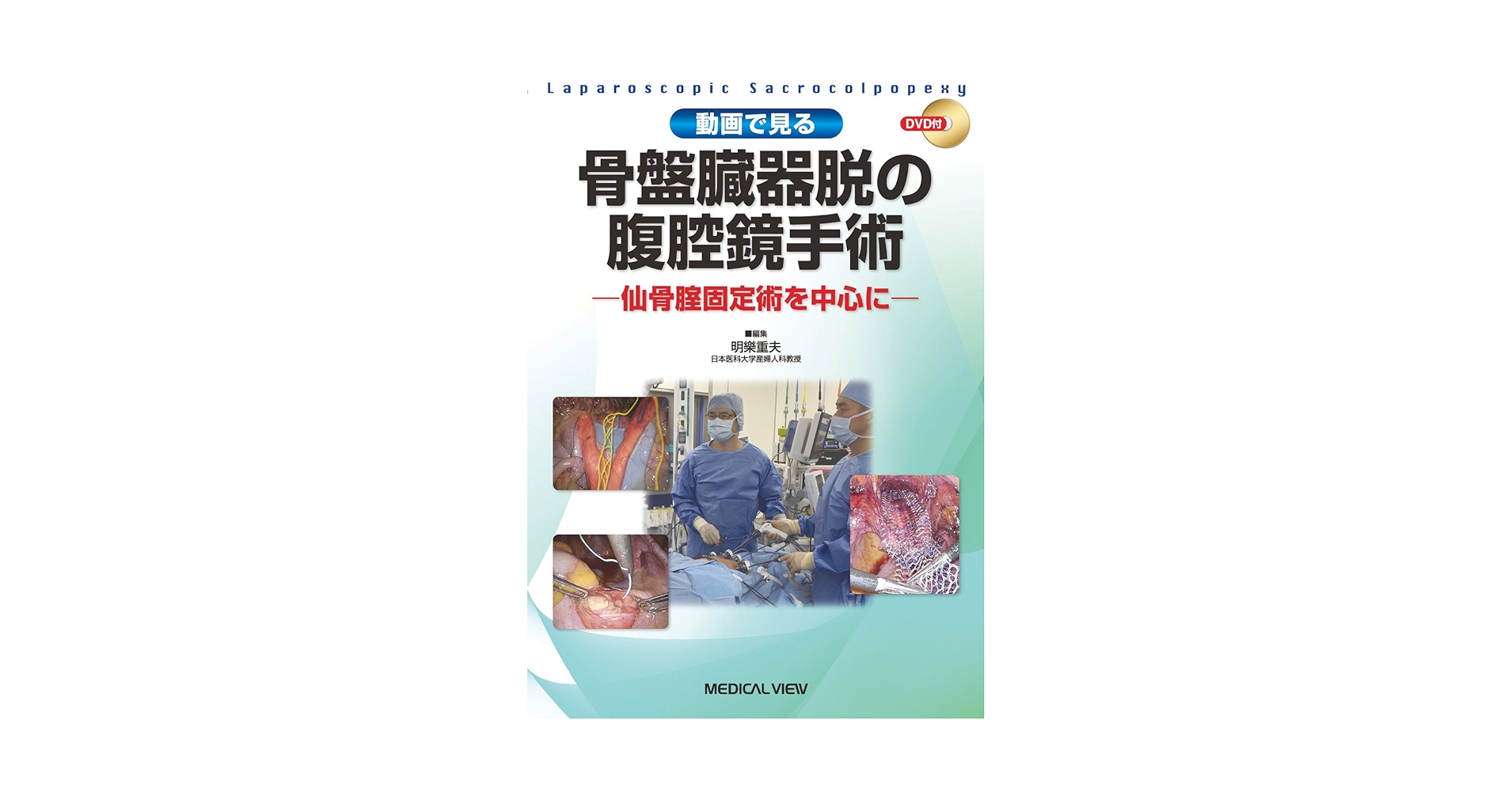 動画で見る 骨盤臓器脱の腹腔鏡手術−仙骨腟固定術を中心に