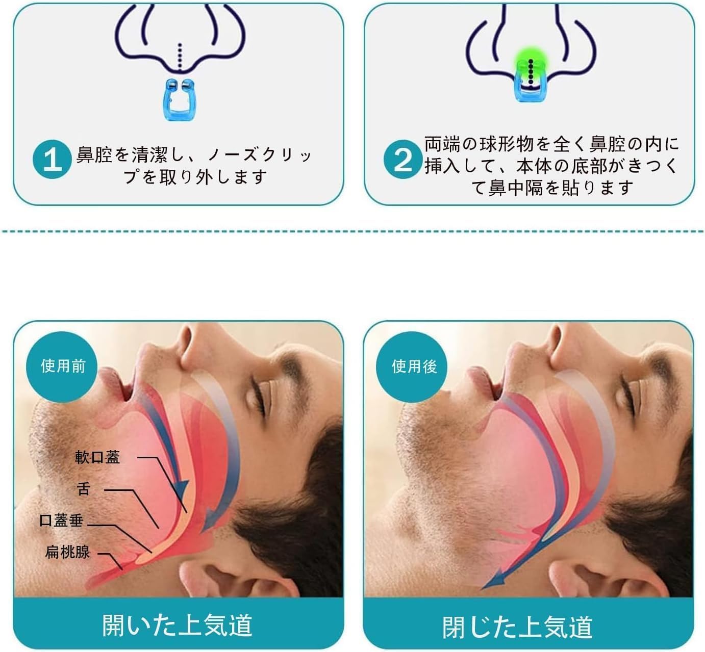 Amazon.co.jp: いびき防止グッズ ノーズクリップ 鼾防止グッズ いびき