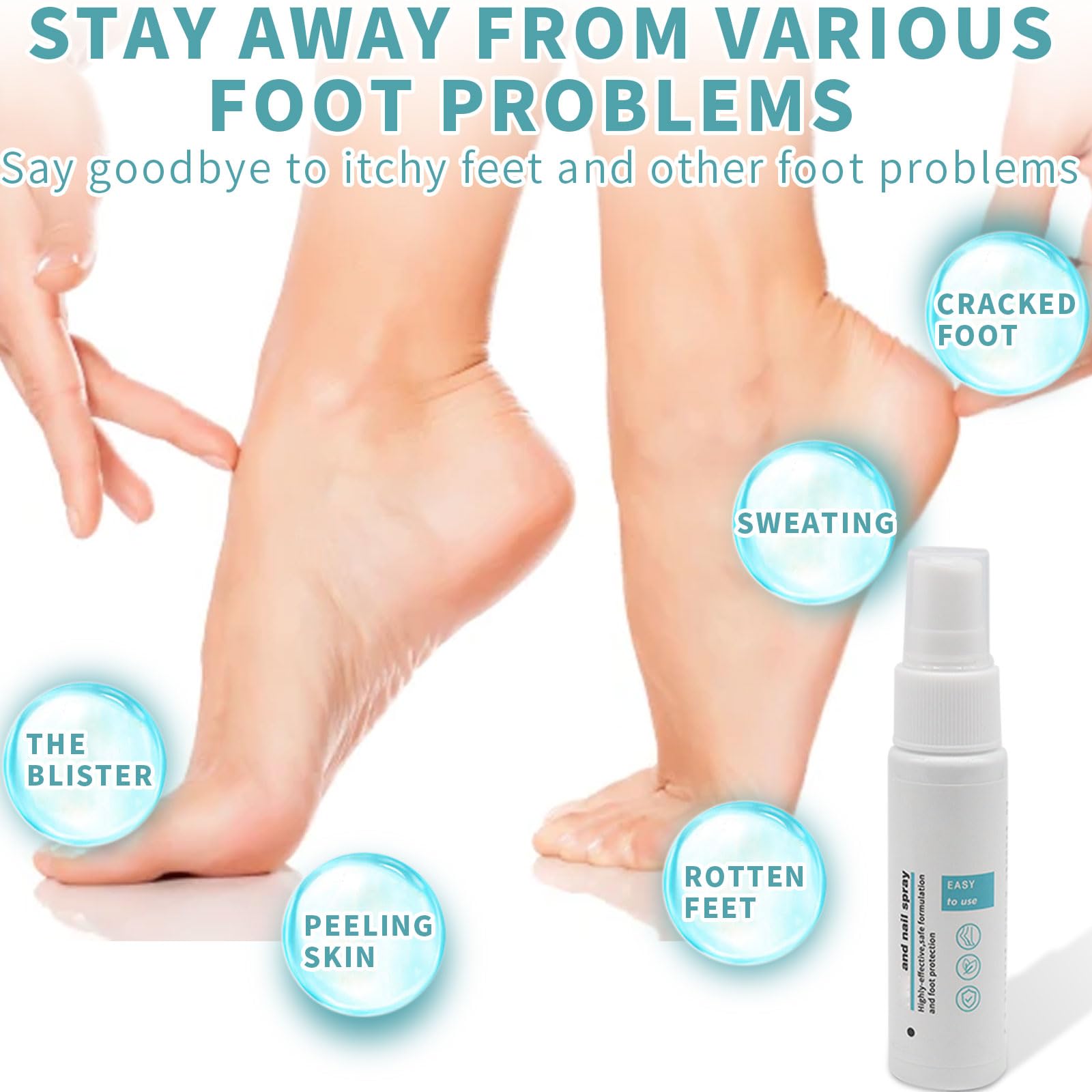 Spray para hongos en los pies, 2 unidades para pies y uñas, spray para hongos en las uñas, spray para pies para reparación de uñas, control de olores, aerosol de pies para reparación de uñas, repair