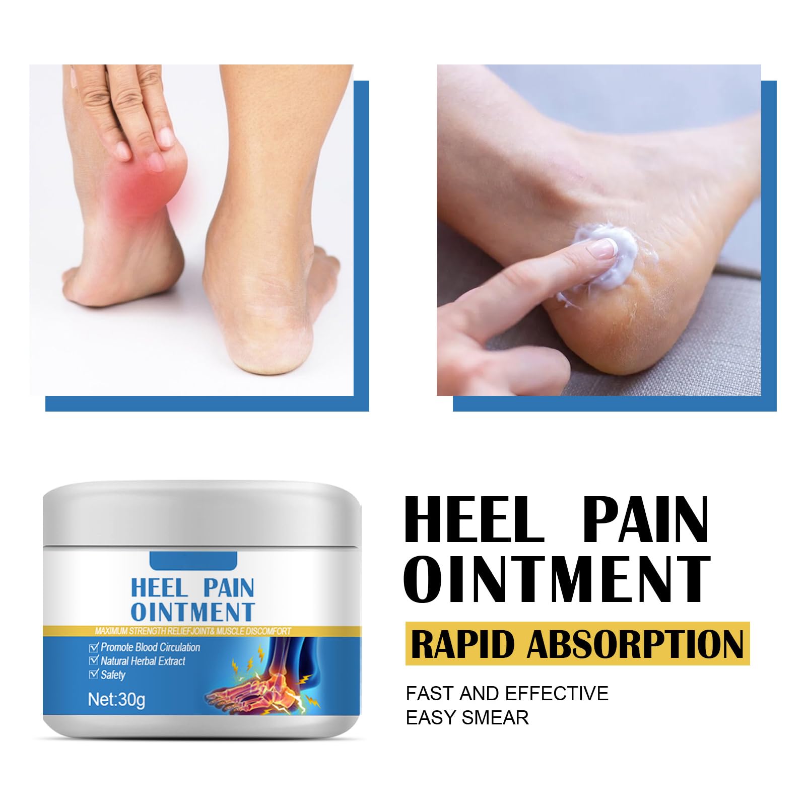 Pomada para Espolones Calcáneos,Crema para el Dolor de Talón,Contra Espolones Calcáneos,Ungüento Calmante para Talones,Crema para el Talón Ungüento Calmante para el Dolor de Pies,30G