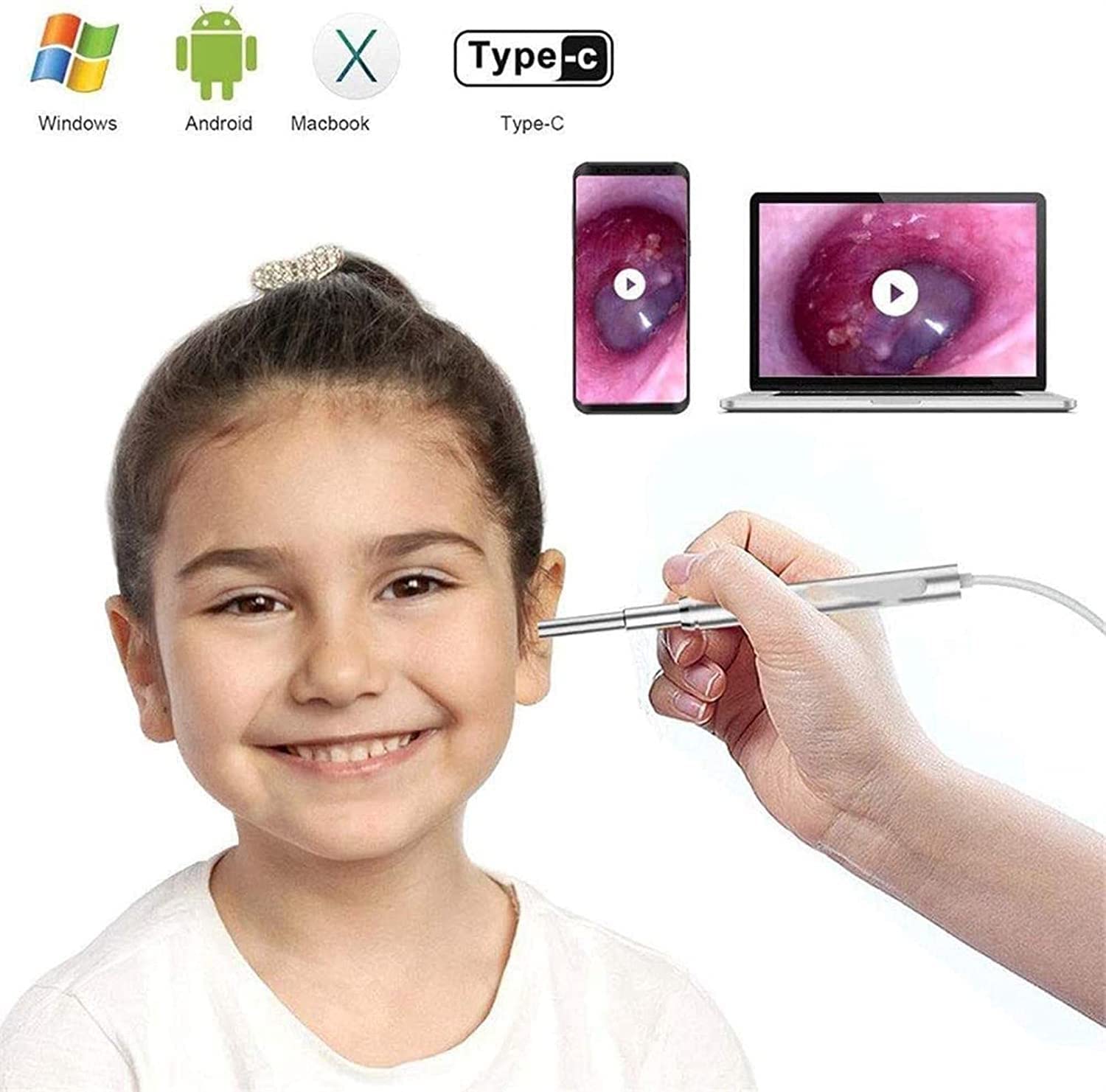 Herramienta de eliminación de Cera de Oreja, 10 0w HD Limpiador de Orejas Oído inalámbrico Otascopio con 6 DIRIGIÓ Luz, ámbito Impermeable for la Oreja con Herramienta removedor de Earwax