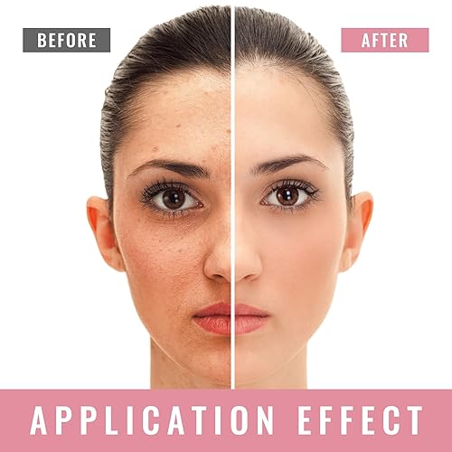 Miniatura 4 de Sueros faciales de vitamina C 4 en 1 con ácido hialurónico, vitamina E, niacinamida, suero facial iluminador de vitamina C para piel seca y apagada,