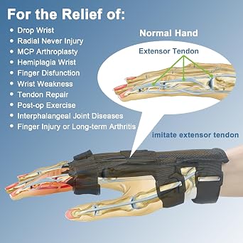 Radial Nerve Palsy Splint, Adjustable Finger Extension Brace, Lift Elastic Splint for Drop Wrist, Radial Nerve Injury, Mcp Arthroplasty, Crutch Palsy Treatment, Fit Left & Right Hand (Plastic)
