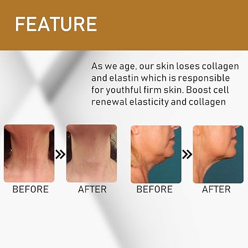 Miniatura 4 de Crema reafirmante para el cuello crema antiarrugas hidratante para cuello y pecho fórmula para apretar levantar y antiarrugas reducción de doble