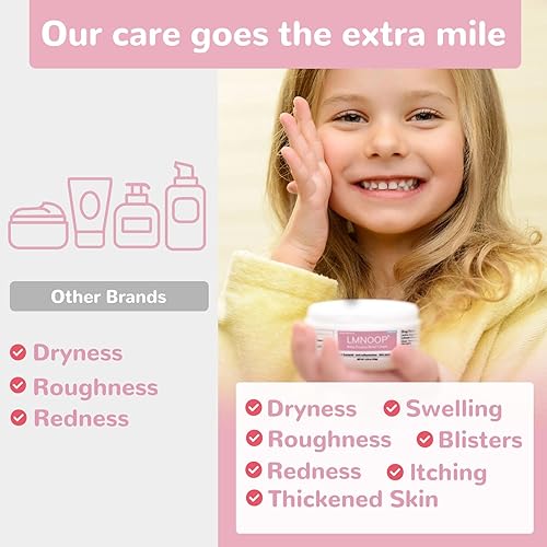 Miniatura 38 de Crema de eccema, ungüento de tratamiento de máxima fuerza para erupción, psoriasis, dermatitis, urticaria, picor de deportista, infección por