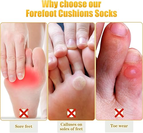 Miniatura 6 de 4 pares de almohadillas metatarsianas para mujer cojines de bola de pie estilo no expuesto almohadillas separadoras de dedo del antepié calcetines