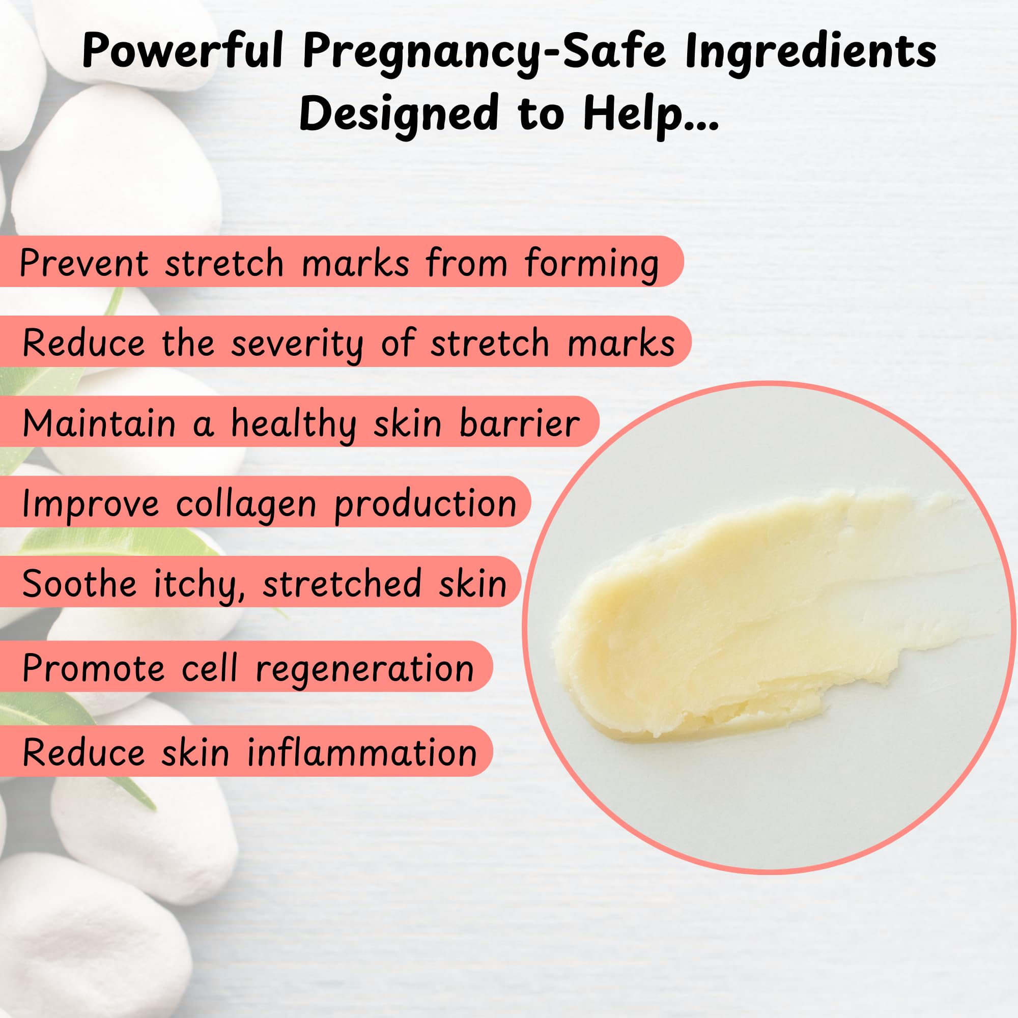 Momstead Stretchies and Stripes Stretch Mark Balm | Intense Relief | Pregnancy Safe