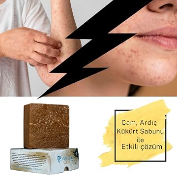 Anatolia Soap 1978 Antioch Collection Pine Juniper Sulfur Natural Special Production Eczema Acne 1 Mold 130 gr. Package of 5