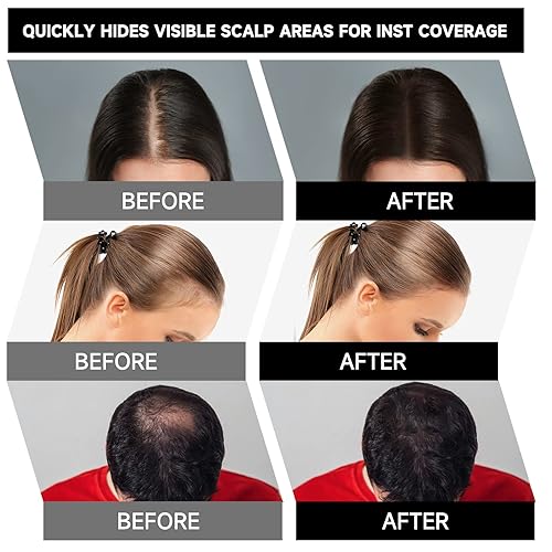 Miniatura 4 de Paquete de 2 polvos para cubrir las raíces y retoques  oculta las canas, adelgazamiento del cabello, línea del cabello, línea de la barba, cejas, al