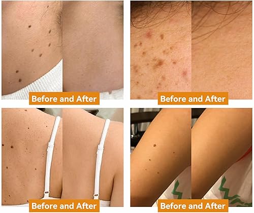 Miniatura 2 de AAFQ Bee Venom Treament & Removal Crema, hidratantes faciales y reparación de la piel para hombres y mujeres, 1.0 fl oz (1)