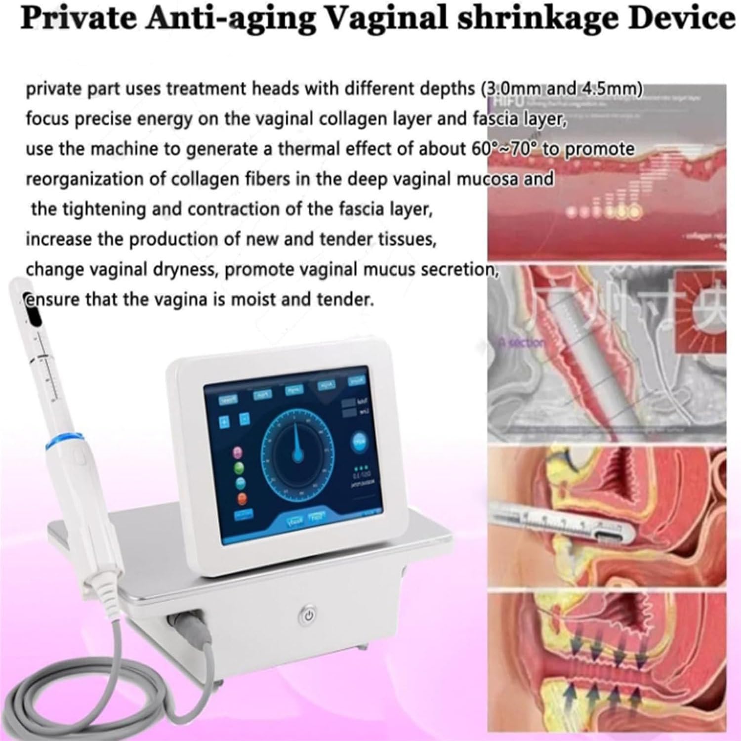 Dispositivo Elettrico per L'allenamento dei Muscoli Pavimento Pelvico per Donne, per Il Recupero Post-Parto, per L'incontinenza E per L'allenamento della Contrazione Muscolare Pelvica