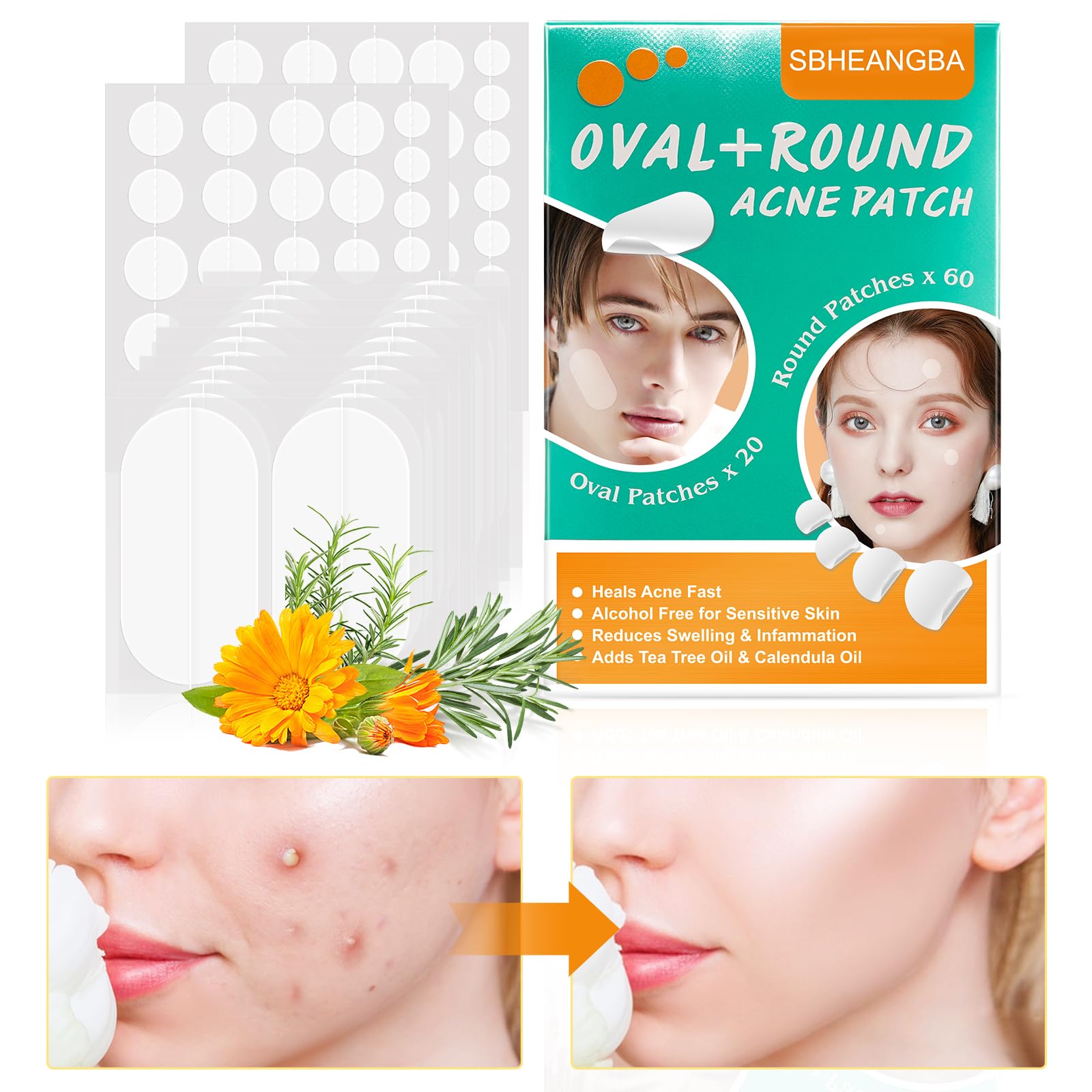 Acne Patches for Face (80 Count) , Round+Oval Five Sizes Pimple Patches Hydrocolloid Zit Patches For Face, Absorbing Hydrocolloid Spot Treatment Fast Healing, Blemish Cover, Hydrocolloid Acne Patch