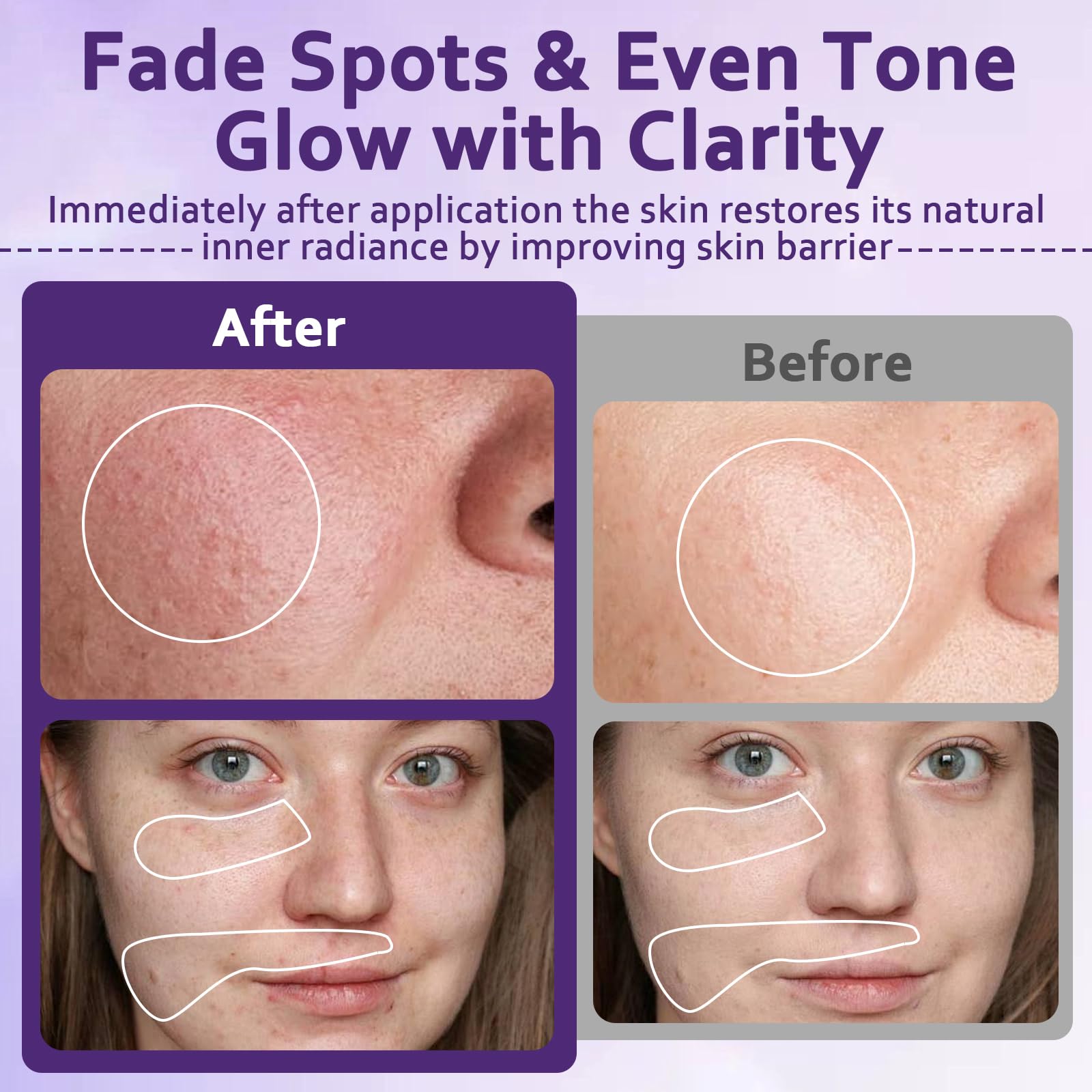 GMHLLES 2 Bottles of Anti-Hyperpigmentation Cream, Dark Spot Cream, with 1 Pair of Eye Patches, Nourishing and Moisturizing - Image 2