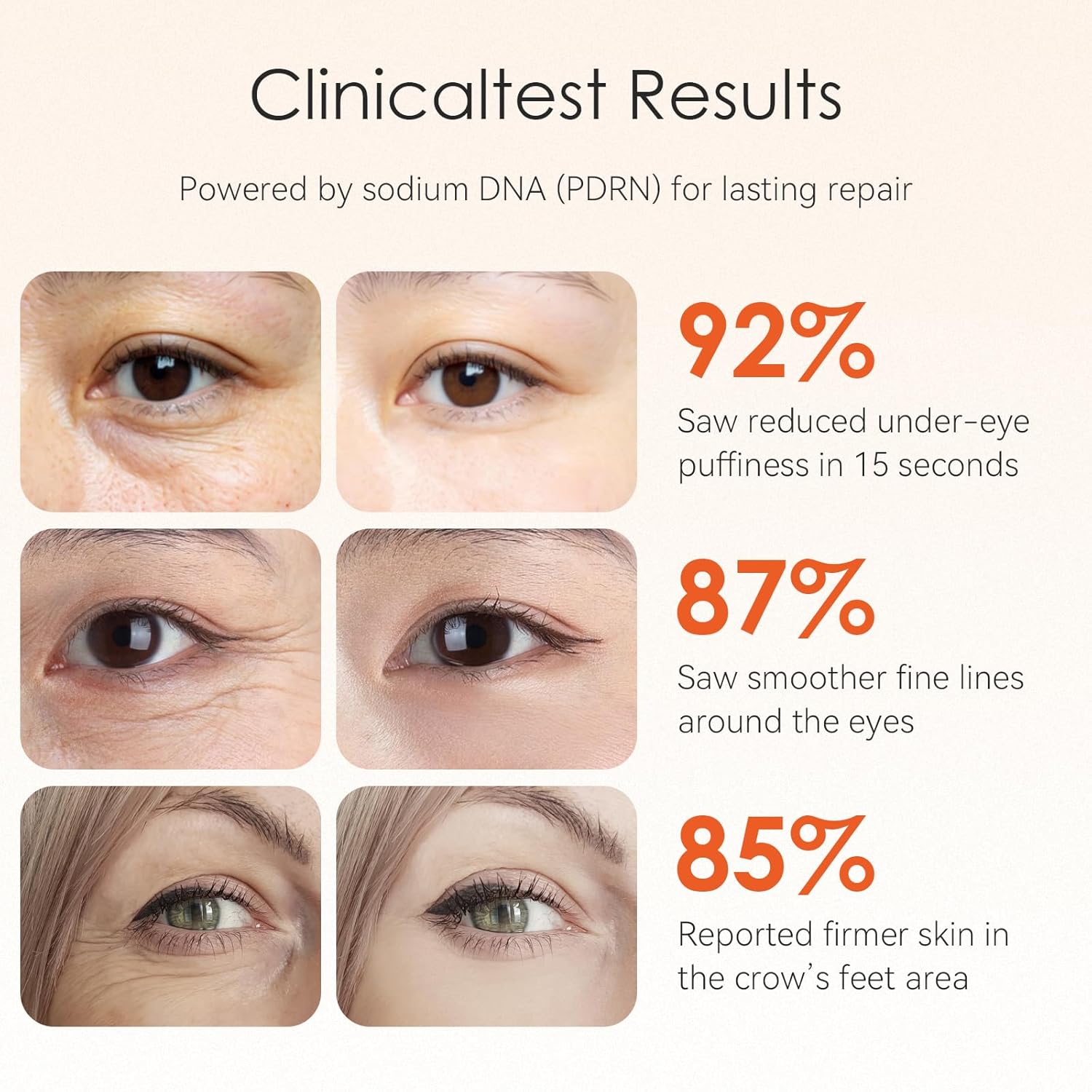 15-Second Instant Eye Lift Cream with Sodium DNA & 0.1% Retinal | Rapid Tightening for Eye Bags & Fine Lines | Dual-Action Firming + Long-Term Repair (0.7 Fl Oz (Pack of 1))