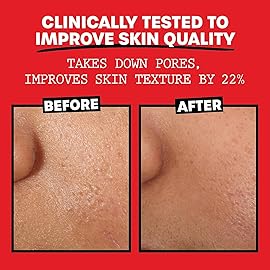 THAYERS Alcohol-Free, Hydrating, Unscented Witch Hazel Facial Toner with Aloe Vera Formula, Vegan, Dermatologist Tested and Recommended, 12 Oz (Pack of 2)