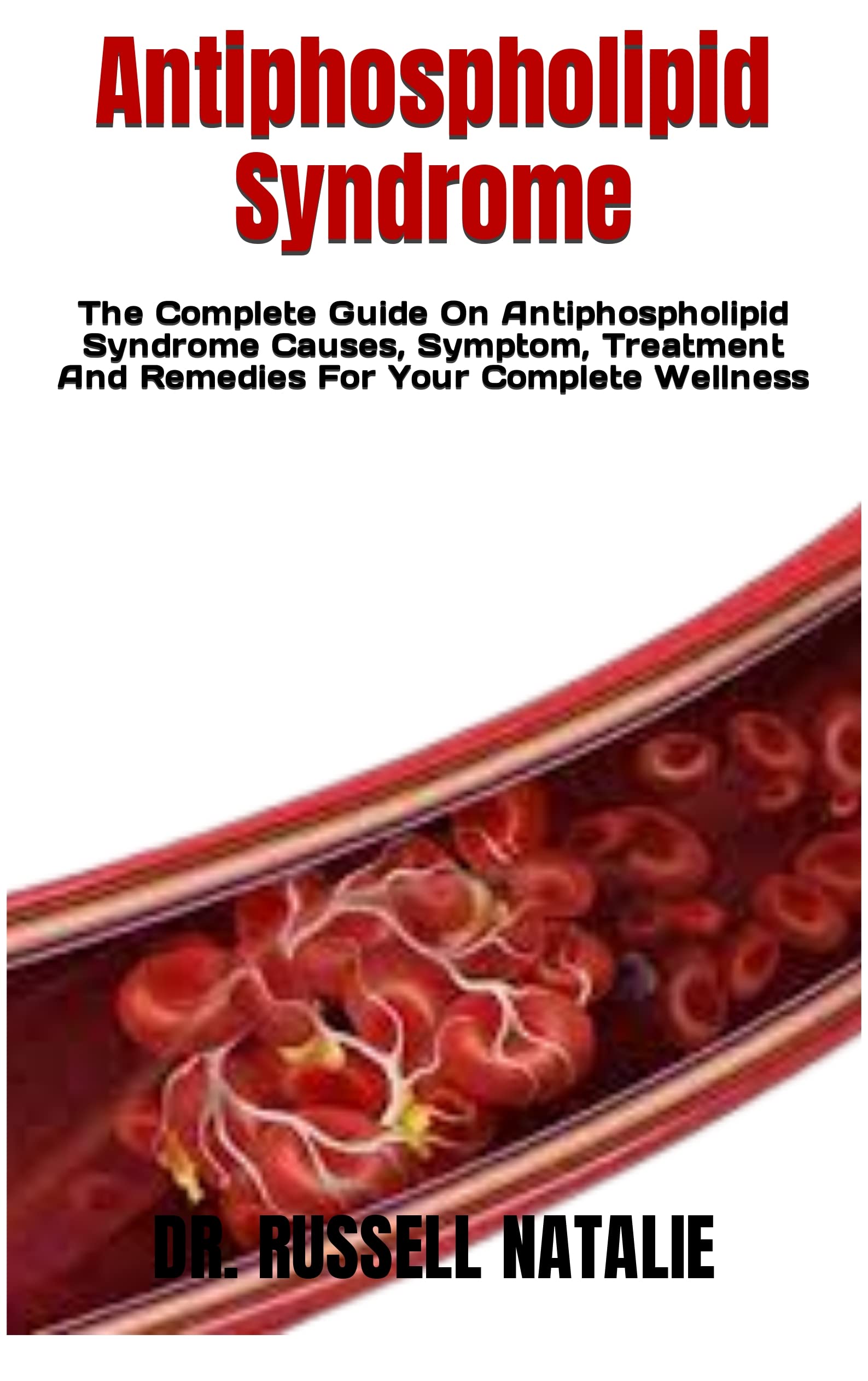 Antiphospholipid Syndrome : The Complete Guide On Antiphospholipid Syndrome Causes, Symptom, Treatment And Remedies For Your Complete Wellness