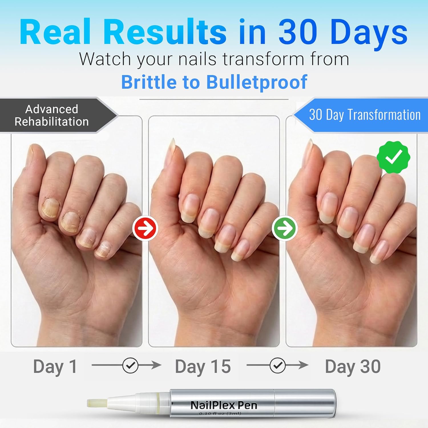 NailPlex Pen, Nail Strengthener and Cuticle Moisturizer, 2 oz / 5ml