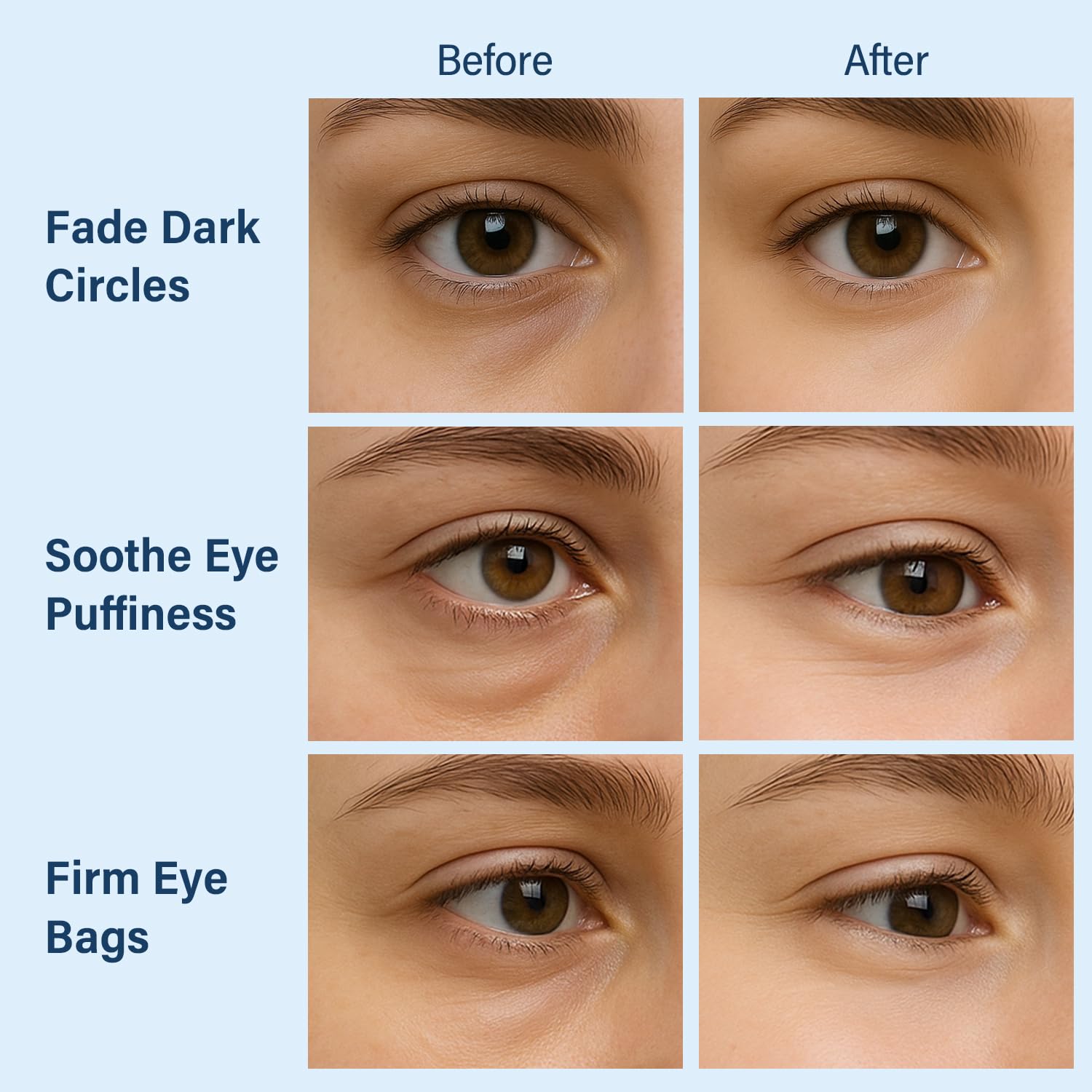 Tintark Patch Occhi Sirius’ly Bright 28 Paia – Hydrogel Eye Mask con Caffeina, Acido Ialuronico e Estratto di Muschio d’Iride, Riduce Occhiaie e Borse, Regalo Donna Cura di Sé e Relax